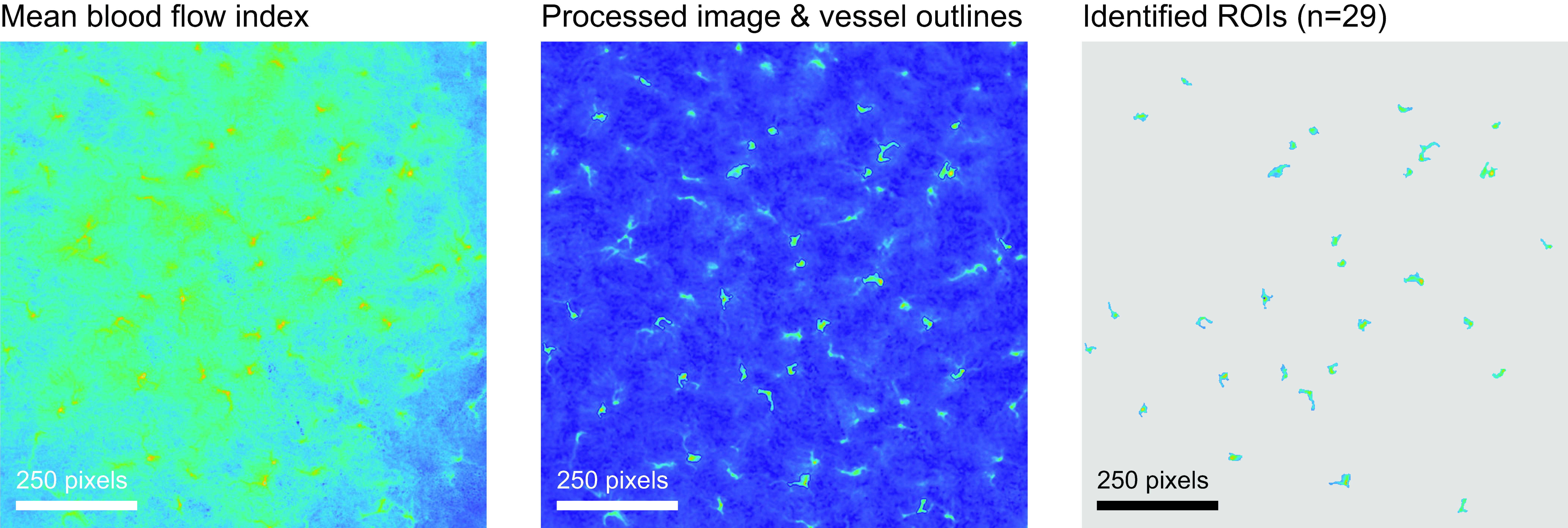 Reduced tubuloglomerular feedback activity and absence of its synchronization in a connexin40 knockout rat